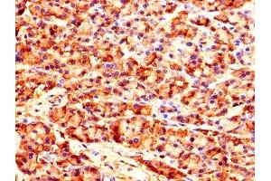 Immunohistochemistry of paraffin-embedded human pancreatic tissue using ABIN7149038 at dilution of 1:100 (CARS 抗体  (AA 201-500))