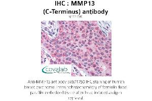 Image no. 1 for anti-Matrix Metallopeptidase 13 (Collagenase 3) (MMP13) (C-Term) antibody (ABIN1737010) (MMP13 抗体  (C-Term))