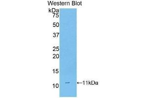 Western Blotting (WB) image for anti-CD3d Molecule, delta (CD3-TCR Complex) (CD3D) (AA 22-106) antibody (ABIN3205925) (CD3D 抗体  (AA 22-106))