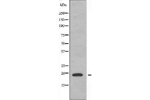 Western blot analysis of extracts from RAW264. (PTTG1IP 抗体  (C-Term))