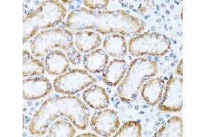 Immunohistochemistry of paraffin-embedded Mouse kidney using INHBC Polyclonal Antibody at dilution of 1:100 (40x lens). (INHBC 抗体)