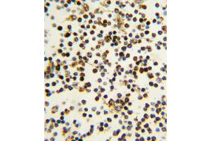 Formalin-fixed and paraffin-embedded human lymph tissue reacted with N antibody (N-term) (ABIN389342 and ABIN2839451) , which was peroxidase-conjugated to the secondary antibody, followed by DAB staining. (NPM1 抗体  (N-Term))