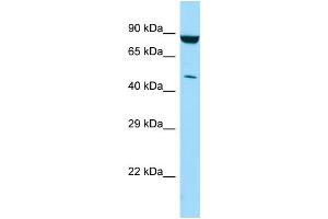 WB Suggested Anti-PIP4K2C Antibody Titration: 1.