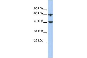 Human Lung; WB Suggested Anti-APOBEC4 Antibody Titration: 0. (APOBEC4 抗体  (N-Term))
