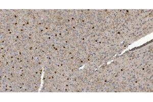 IHC analysis of Alpha B Crystallin/CRYAB using anti-Alpha B Crystallin/CRYAB antibody (ABIN7601209).