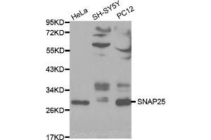 Western blot analysis of extracts of various cell lines, using SNAP25 antibody (ABIN5970374) at 1/1000 dilution. (SNAP25 抗体)