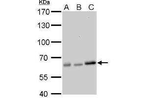 Western Blotting (WB) image for anti-Protein Kinase, AMP-Activated, alpha 2 Catalytic Subunit (PRKAA2) (Center) antibody (ABIN2855639)