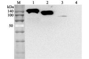 Western blot analysis using anti-ACE2 (human), mAb (AC384)  at 1:2'000 dilution. (ACE2 抗体)