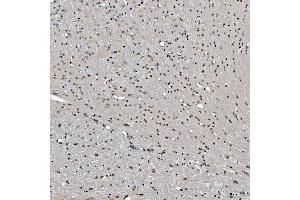 IHC analysis of SNRNP27 using anti-SNRNP27 antibody (ABIN7599614).