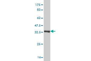 Western Blotting (WB) image for anti-CAMP Responsive Element Binding Protein 3-Like 4 (CREB3L4) (AA 1-110) antibody (ABIN566851)