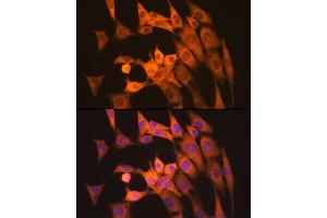 Immunofluorescence analysis of NIH-3T3 cells using Calpain 1 Rabbit mAb (ABIN7266033) at dilution of 1:100 (40x lens). (CAPNL1 抗体)