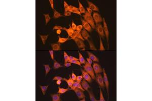 Immunofluorescence analysis of NIH-3T3 cells using Calpain 1 Rabbit mAb (ABIN7266033) at dilution of 1:100 (40x lens). (CAPNL1 抗体)