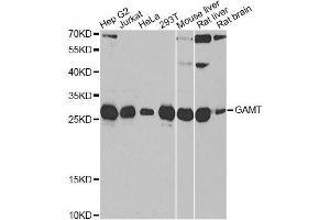 Western blot analysis of extracts of various cell lines, using GAMT antibody. (GAMT 抗体  (AA 1-236))