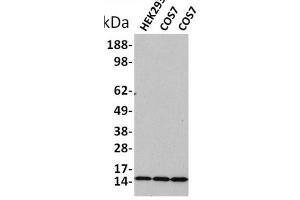 Western blot analysis of extracts of various celllines,using Acetyl-Histone H3 (Lys18) Antibody. (Histone 3 抗体  (H3K18ac))