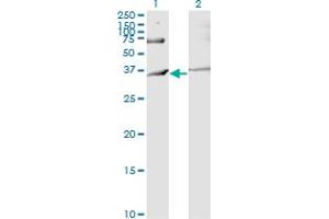 Western Blot analysis of RNF144B expression in transfected 293T cell line by IBRDC2 monoclonal antibody (M02), clone 4F1. (RNF144B 抗体  (AA 1-100))