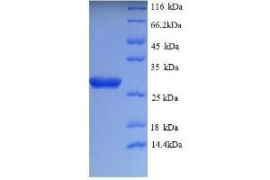 SDS-PAGE (SDS) image for Ubiquitin Carboxyl-terminal Esterase L1 (Ubiquitin Thiolesterase) (UCHL1) (AA 1-222), (partial) protein (His tag) (ABIN1047864)