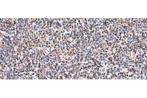 Immunohistochemistry of paraffin-embedded Human tonsil tissue using HSF2BP Polyclonal Antibody at dilution of 1:30(x200) (HSF2BP 抗体)
