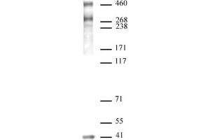 SMRT / NCoR2 antibody (pAb) tested by Western blot.