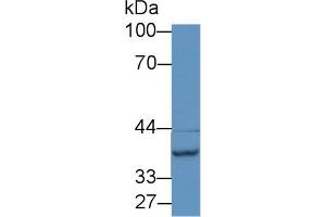 Detection of NAT2 in Mouse Liver lysate using Polyclonal Antibody to N-Acetyltransferase 2 (NAT2) (NAT2 抗体  (AA 20-280))