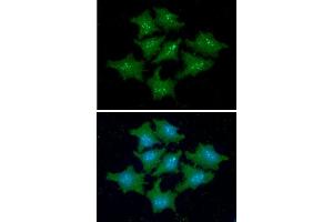 ICC/IF analysis of FKBP14 in HeLa cells line, stained with DAPI (Blue) for nucleus staining and monoclonal anti-human FKBP14 antibody (1:100) with goat anti-mouse IgG-Alexa fluor 488 conjugate (Green). (FKBP14 抗体)