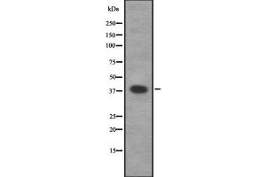 Western blot analysis of CAMK1 using Jurkat whole  lysates. (CAMK1 抗体  (Internal Region))