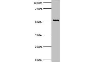 Western blot All lanes: Interleukin-1 receptor-associated kinase 4 antibody at 4 μg/mL + Jurkat whole cell lysate Secondary Goat polyclonal to rabbit IgG at 1/10000 dilution Predicted band size: 52, 38 kDa Observed band size: 52 kDa (IRAK4 抗体  (AA 1-220))