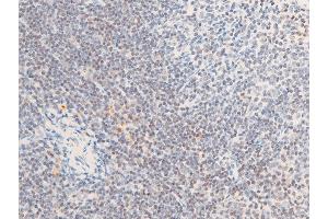 ABIN6267285 at 1/100 staining mouse spleen tissue sections by IHC-P. (ErbB2/Her2 抗体  (pTyr1112))