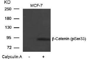 Image no. 1 for anti-Catenin (Cadherin-Associated Protein), beta 1, 88kDa (CTNNB1) (pSer33) antibody (ABIN196956) (CTNNB1 抗体  (pSer33))