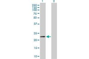 Western Blot analysis of CSN3 expression in transfected 293T cell line by CSN3 MaxPab polyclonal antibody. (CSN3 抗体  (AA 1-182))