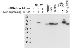 Image no. 1 for anti-Selenophosphate Synthetase 2 (SEPHS2) antibody (ABIN401044) (SEPHS2 抗体)