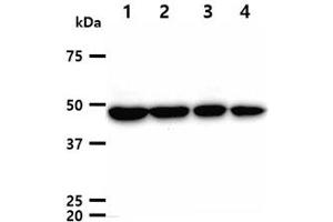The cell lysates (40ug) were resolved by SDS-PAGE, transferred to PVDF membrane and probed with anti-human TUBG1 antibody (1:1000). (TUBG1 抗体)