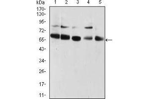 Western Blotting (WB) image for anti-Chromobox Homolog 2 (CBX2) (AA 402-525) antibody (ABIN5542422)