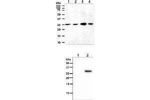 The cell lysates (40ug) were resolved by SDS-PAGE, transferred to PVDF membrane and probed with anti-human OSTF1 antibody (1:1000). (OSTF1 抗体)