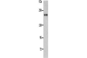 Western Blotting (WB) image for anti-Nephrosis 1, Congenital, Finnish Type (Nephrin) (NPHS1) antibody (ABIN2431713) (Nephrin 抗体)