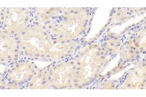 Detection of PCNT in Human Kidney Tissue using Polyclonal Antibody to Pericentrin (PCNT) (PCNT 抗体  (AA 2987-3246))