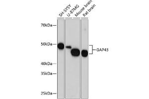 Western blot analysis of extracts of various cell lines, using G antibody (ABIN7267515) at 1:1000 dilution. (GAP43 抗体)