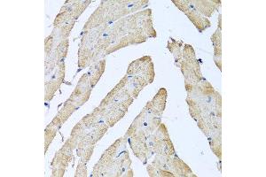 Immunohistochemistry of paraffin-embedded mouse heart using ATAD3B antibody at dilution of 1:100 (x40 lens). (ATAD3B 抗体)