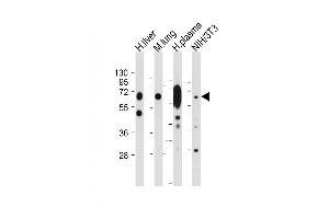 All lanes : Anti-LGALS3BP Antibody (Center) at 1:2000 dilution Lane 1: Human liver tissue lysate Lane 2: Mouse lung tissue lysate Lane 3: Human plasma tissue lysate Lane 4: NIH/3T3 whole cell lysate Lysates/proteins at 20 μg per lane. (LGALS3BP 抗体  (AA 383-412))