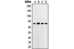 Western blot analysis of PGHS-2 expression in HeLa (A), Jurkat (B), Raw264. (PTGS2 抗体  (C-Term))