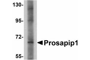 Image no. 1 for anti-ProSAP-Interacting Protein 1 (PROSAPIP1) (C-Term) antibody (ABIN478164) (ProSAPiP1 抗体  (C-Term))