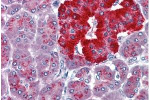 Immunohistochemistry (Paraffin-embedded Sections) (IHC (p)) image for anti-Paired Box 4 (PAX4) (AA 166-215) antibody (ABIN462174)