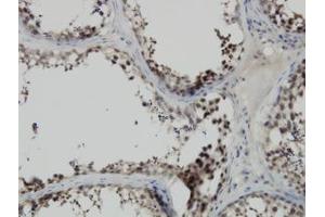 Image no. 1 for anti-PDZ Binding Kinase (PBK) (AA 1-110) antibody (ABIN599274) (PBK 抗体  (AA 1-110))