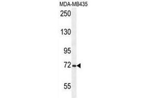 ARHGAP10 Antibody (Center) western blot analysis in MDA-MB435 cell line lysates (35µg/lane). (ARHGAP10 抗体  (Middle Region))