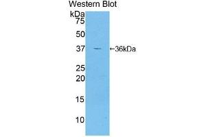 Western Blotting (WB) image for anti-Glutamate Decarboxylase 2 (Pancreatic Islets and Brain, 65kDa) (GAD2) (AA 65-105) antibody (ABIN7433339)