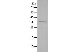 Western Blotting (WB) image for Proteolipid Protein 1 (PLP1) (AA 2-277) protein (His tag) (ABIN7124694)
