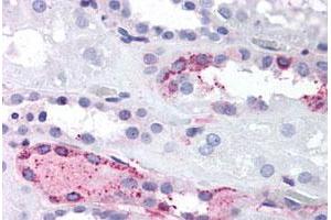 Immunohistochemical (Formalin/PFA-fixed paraffin-embedded sections) staining in human kidney with LPAR4 polyclonal antibody . (LPAR4 抗体  (C-Term))
