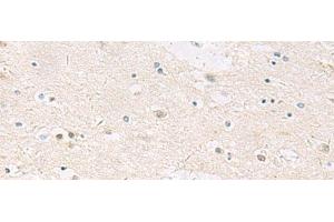 Immunohistochemistry of paraffin-embedded Human brain tissue using ANKS6 Polyclonal Antibody at dilution of 1:55(x200) (ANKS6 抗体)