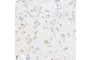 Immunohistochemistry (IHC) image for anti-Stearoyl-CoA Desaturase (Delta-9-Desaturase) (SCD) (C-Term) antibody (ABIN7270589)