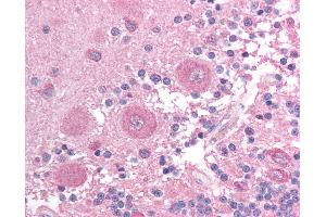 Anti-BCL2L14 / Bcl G antibody IHC of human brain, cerebellum. (BCL2L14 / BCL-G (C-Term) 抗体)