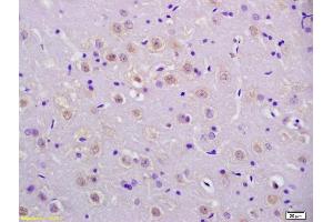 Immunohistochemistry (IHC) image for anti-Tumor Protein P53 (TP53) (pSer20) antibody (ABIN702895)